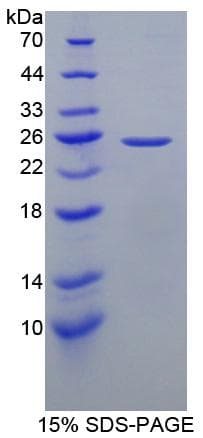 Human GFAP Protein (Recombinant His-S)