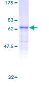 Human STAC3 Protein (Recombinant GST)