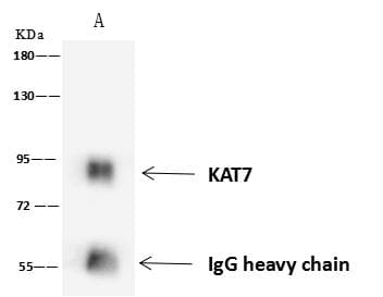 MYST2 / HBO1 Antibody