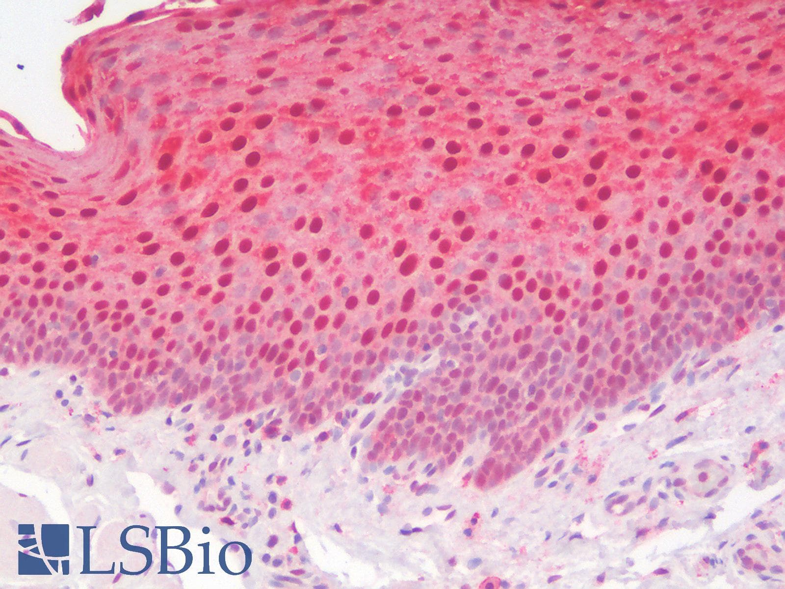 PathPlus™ Polyclonal Rabbit anti-Human ANXA1 / Annexin A1 Antibody (IHC)