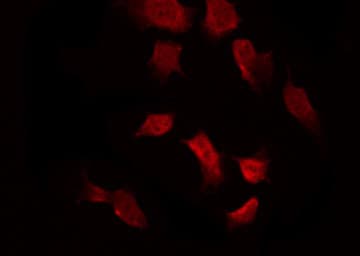 PRKAA1 / AMPK Alpha 1 Antibody (phospho-Thr172)
