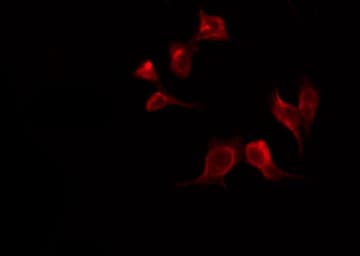 Polyclonal Rabbit anti-Human PLCG1 Antibody (phospho-Tyr771, IHC, IF, WB)