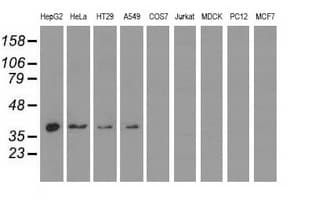 Monoclonal Mouse anti-Human HIBCH Antibody (clone OTI3G1, IF, WB)