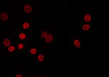 AARSD1 Antibody