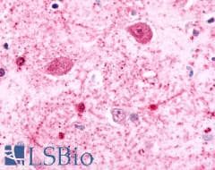 PathPlus™ ADGRB2 / BAI2 Antibody (N-Terminus)