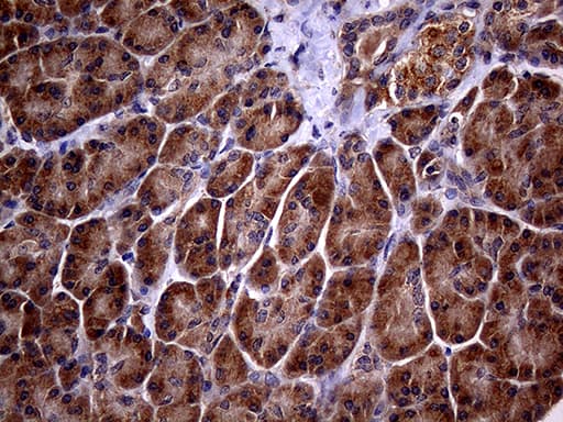 p16INK4a / CDKN2A Antibody (clone OTI5H8)
