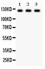 PLD1 / Phospholipase D1 Antibody (aa1-330)