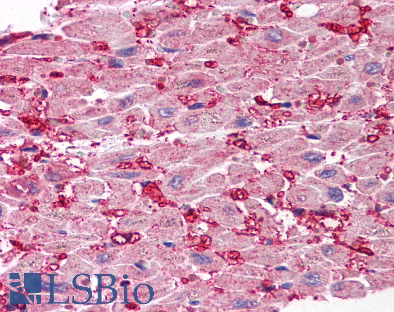 IHC-plus™ Polyclonal Rabbit anti-Human SCO1 Antibody (IHC, IF, WB)