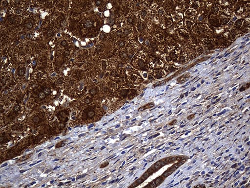 Monoclonal Mouse anti-Human ALDH7A1 Antibody (clone OTI1A9, IHC, WB)