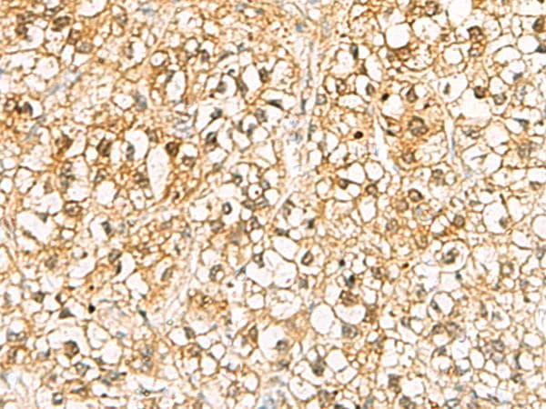 Polyclonal Rabbit anti-Human C11orf54 Antibody (IHC)
