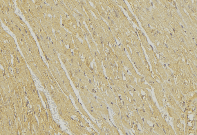 BIK Antibody