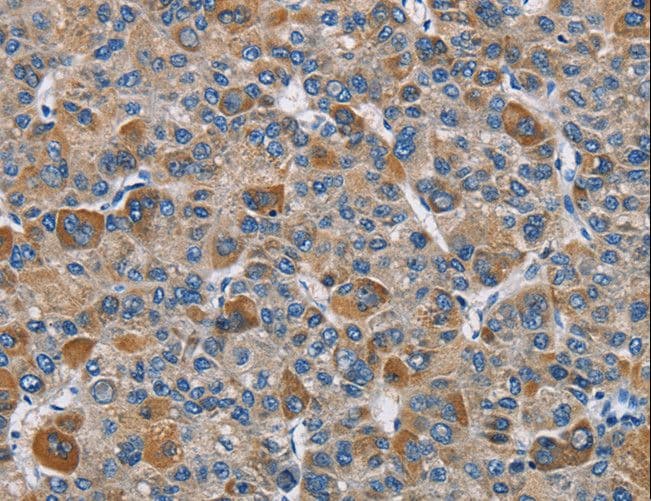 Polyclonal Rabbit anti-Human DNMT3A Antibody (IHC)