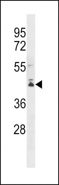 PCMTD2 Antibody (aa251-278)