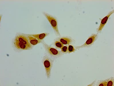 HIST1H1C Antibody