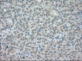 NTRK3 / TRKC Antibody (clone OTI24B3)