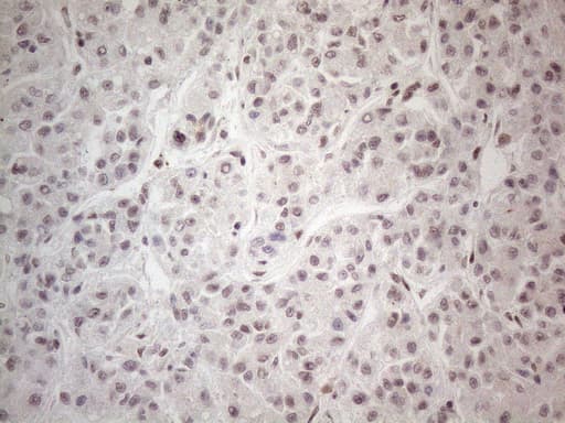 NR2C2 / TAK1 Antibody (aa1-241, clone OTI4B1)
