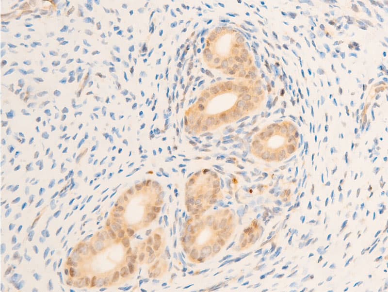MAP3K7 / TAK1 Antibody (phospho-Thr187)
