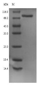 Rat PCSK1 Protein (Recombinant 6His, N-terminus)
