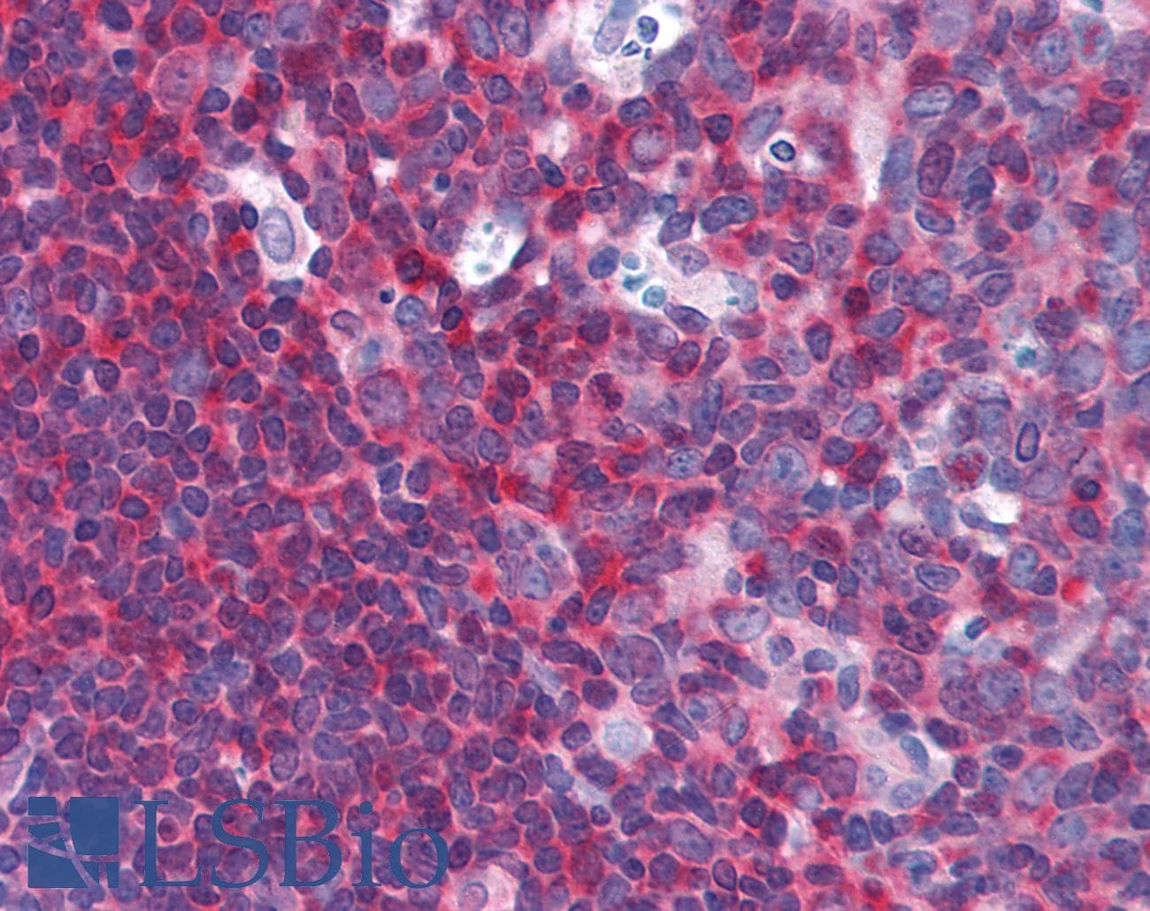 IHC-plus™ NFKB1 / NF-Kappa-B Antibody (clone 4D1)
