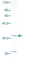 Human MGP / Matrix Gla-Protein (Recombinant GST)