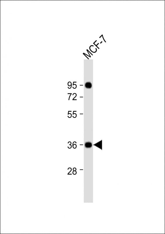 Polyclonal Rabbit anti-Human CXXC5 Antibody (aa47-80, WB)