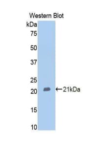 MME / CD10 Antibody (aa382-538, Cy3)