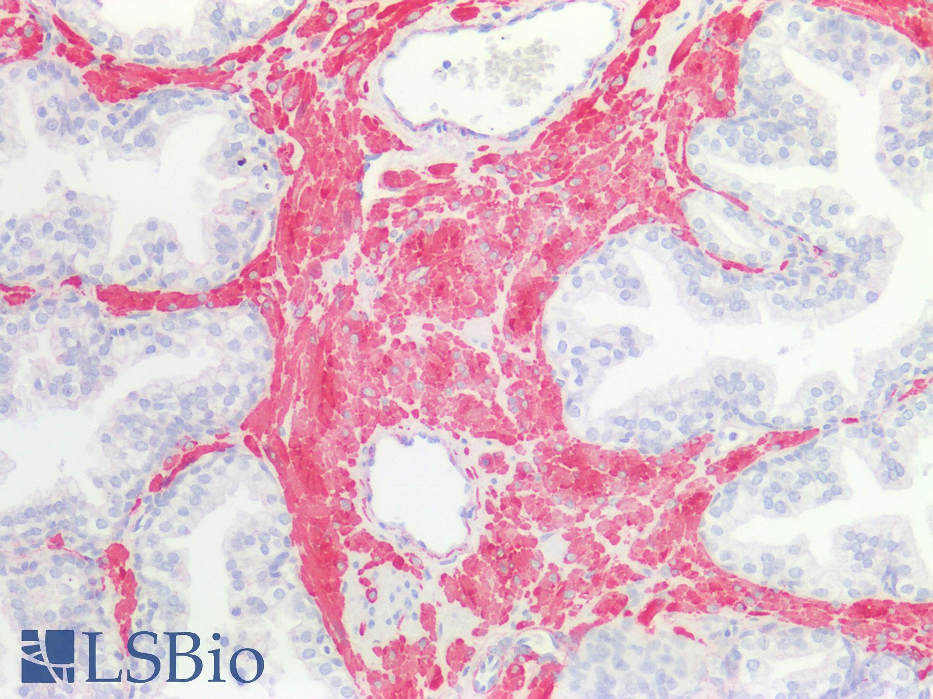 PathPlus™ CALD1 / Caldesmon Antibody (aa1-240)