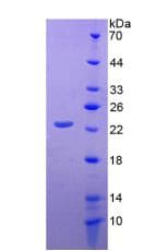 Human CD276 / B7-H3 Protein (Recombinant His, N-Terminal)
