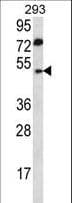 Polyclonal Rabbit anti-Human ABHD2 Antibody (aa263-292, IHC, WB)