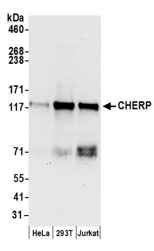 Polyclonal Rabbit anti-Human CHERP Antibody (aa400-450, WB)