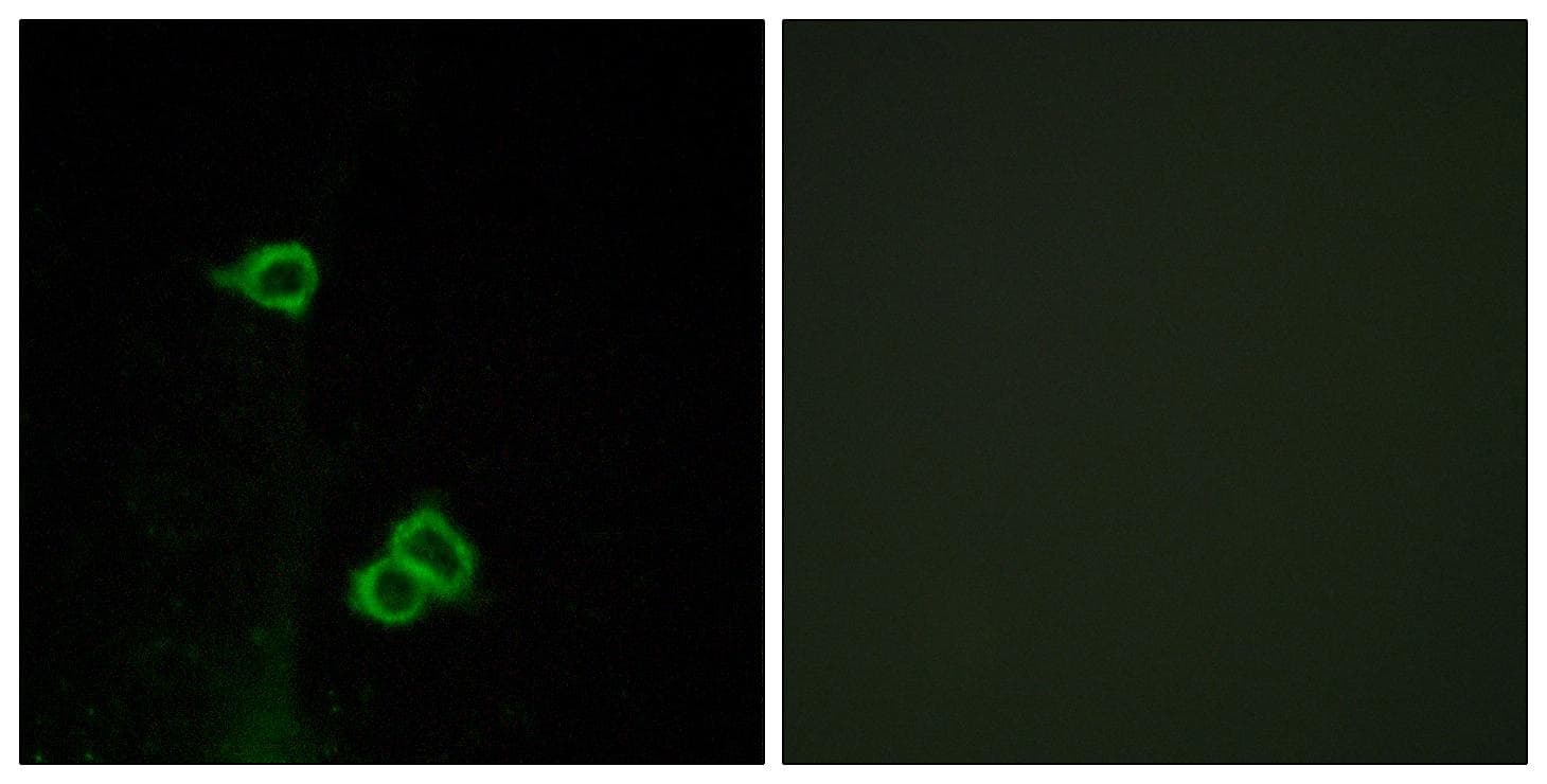 ACKR3 / CXCR7 Antibody
