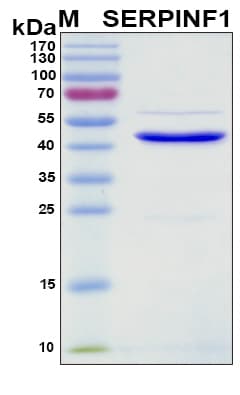 Mouse SERPINF1 / PEDF Protein (Recombinant 6His, N-terminus)