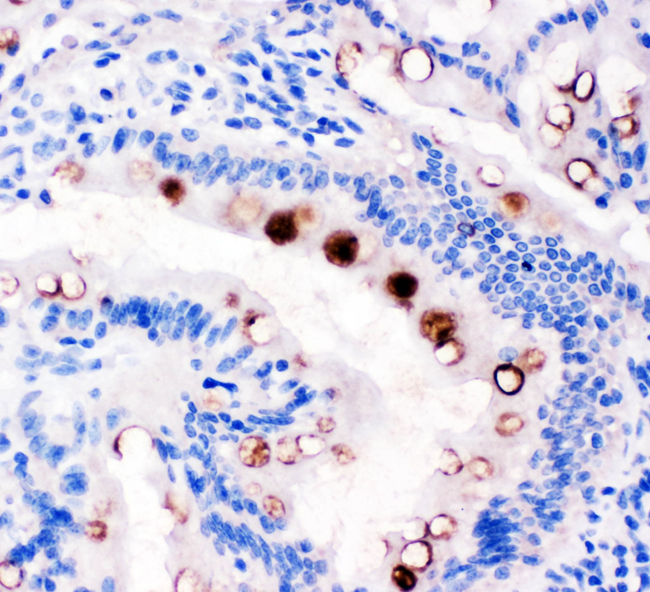 TFF1 / pS2 Antibody (aa59-72)