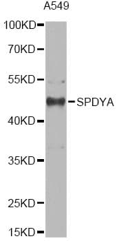 Polyclonal Rabbit anti-Human SPY1 / SPDYA Antibody (IF, WB)