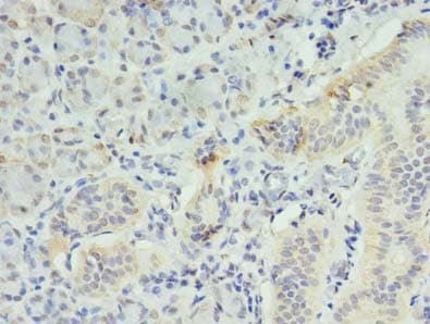 Polyclonal Rabbit anti-Human INPP1 Antibody (IHC)