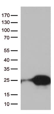 Monoclonal Mouse anti-Human TSEN15 Antibody (clone OTI3F5, Carrier-free, WB)