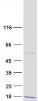 Human S100A5 Protein (Recombinant Myc-DDK (Flag))