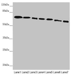 Polyclonal Rabbit anti-Human DYNC1I1 Antibody (IHC, WB)