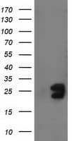 FGF21 Antibody (aa29-209, clone OTI3G9)