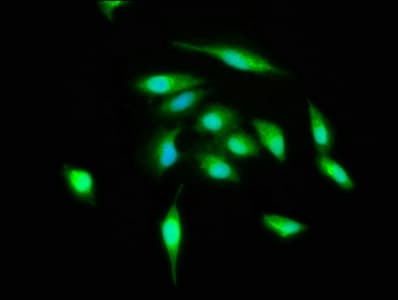 IHC-plus™ Polyclonal Rabbit anti-Human ATG3 Antibody (aa1-314, IHC, WB)