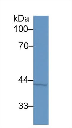 SERPINB5 / Maspin Antibody (aa1-375, APC)