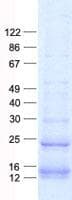 Human NDUFA4L2 Protein (Recombinant His, N-Terminal)