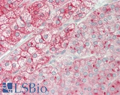 IHC-plus™ Polyclonal Rabbit anti-Human JAGN1 Antibody (IHC, WB)