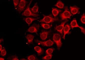 Polyclonal Rabbit anti-Human ALAS1 Antibody (IF, WB)