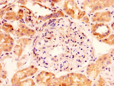 Polyclonal Rabbit anti-Human GLIPR1 / GLIPR Antibody (WB)