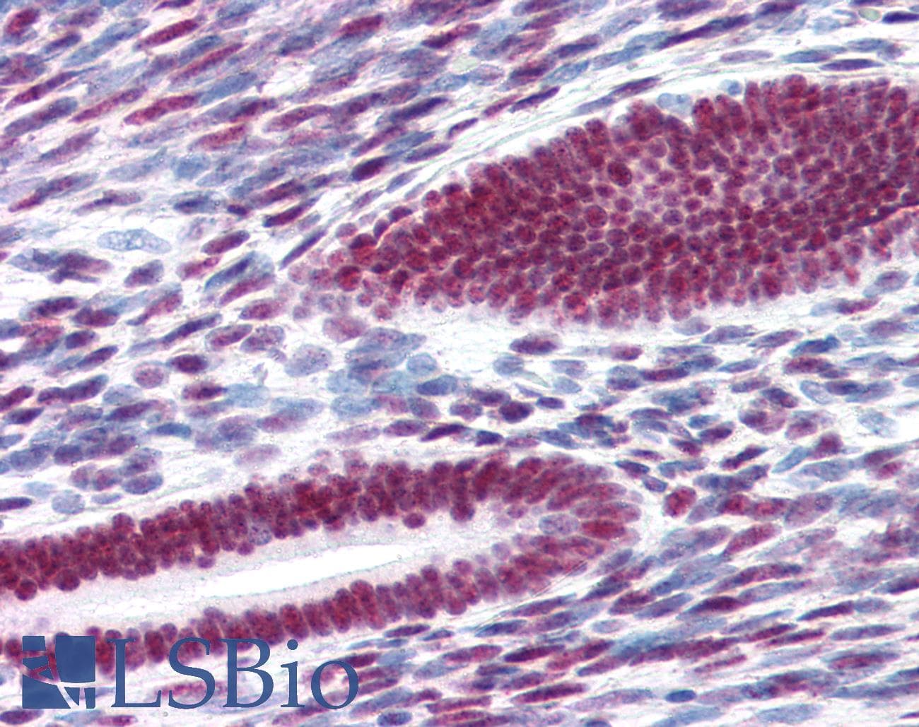 PathPlus™ ER Alpha / Estrogen Receptor Antibody (C-Terminus)