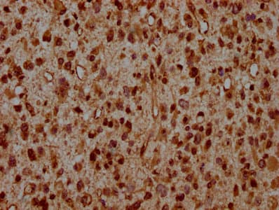 HIST1H2AI Antibody