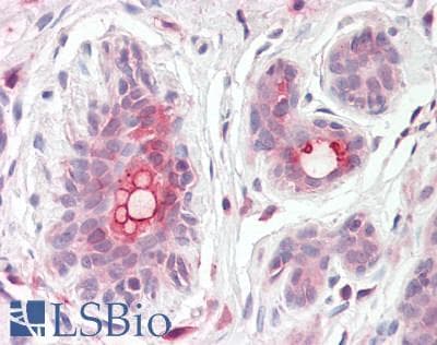 IHC-plus™ ABCC11 / MRP8 Antibody (aa1352-1364)