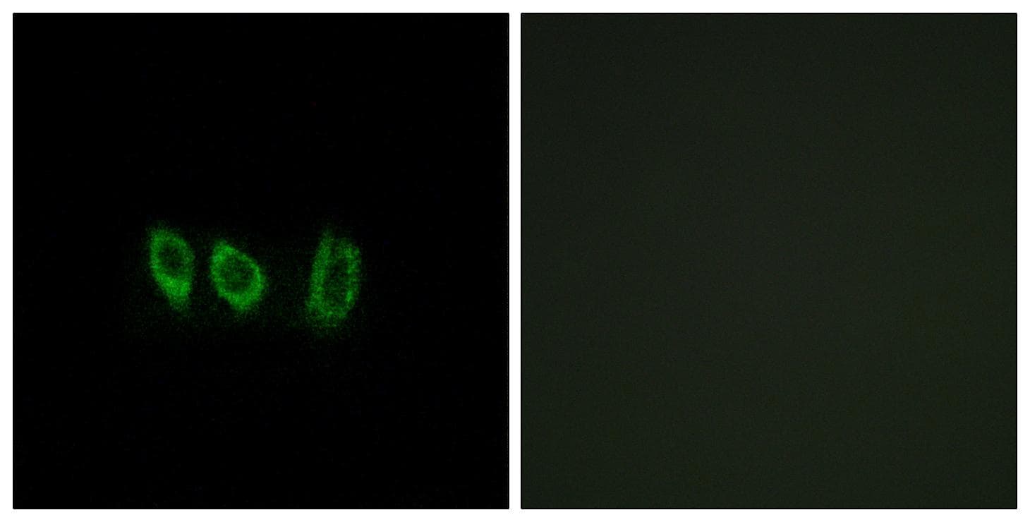 CSTL1 / Cystatin-Like 1 Antibody