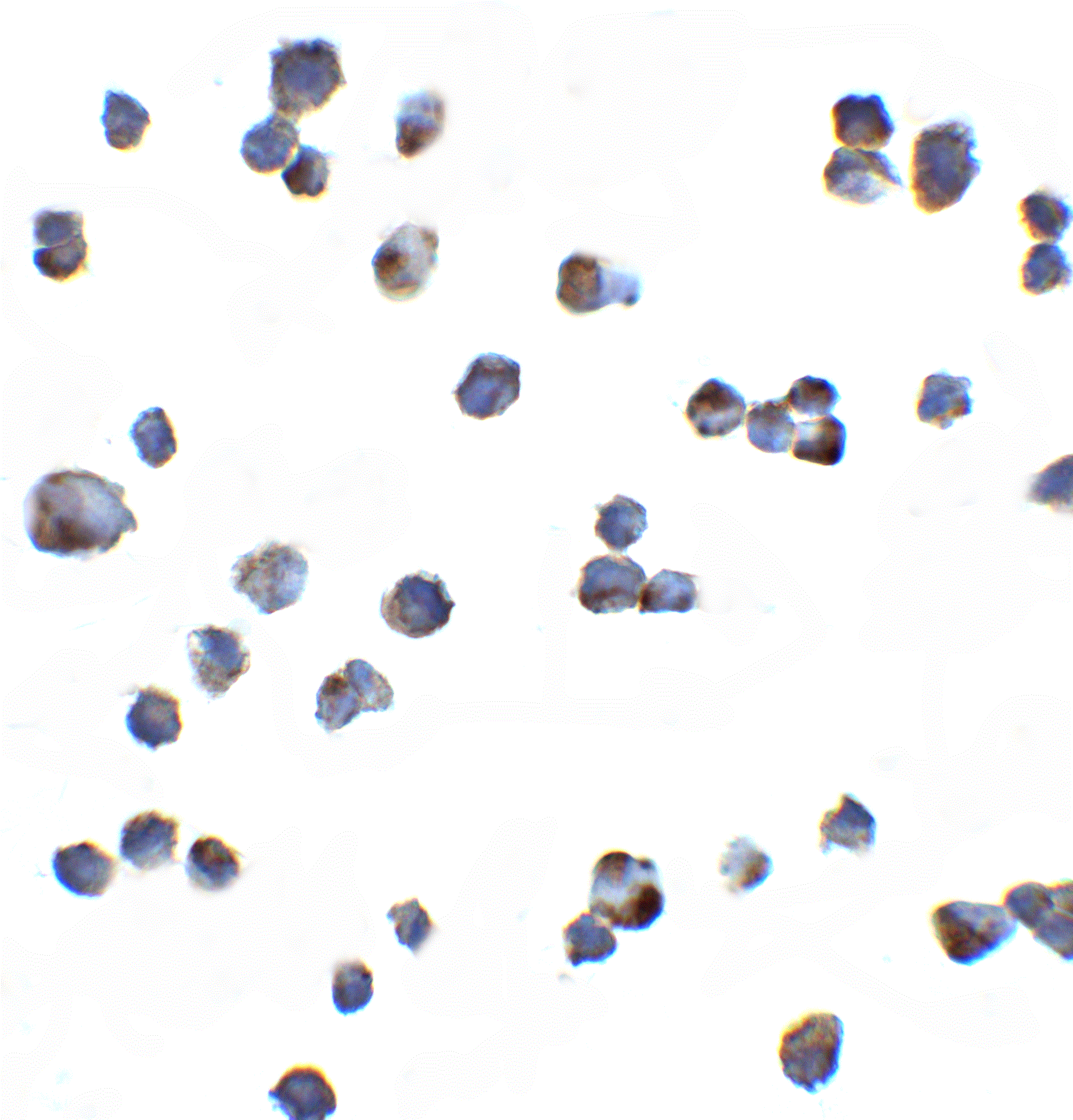Polyclonal Rabbit anti-Human KIR2DS2 / CD158j Antibody (IF, WB)